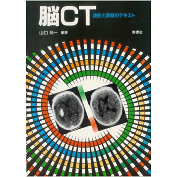脳ct 読影と診断のテキスト pdf epub mobi 电子书 下载