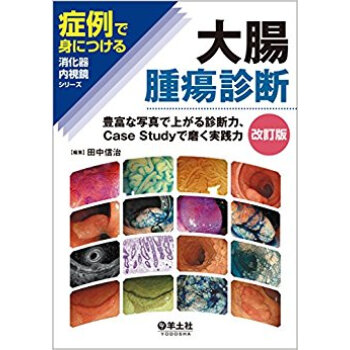 大腸腫瘍診断 豊富な写真で上がる診断力、Case Studyで磨く実践力 pdf epub mobi 电子书 下载