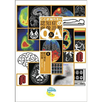 ここが知りたい認知症の画像診断q&A pdf epub mobi 电子书 下载