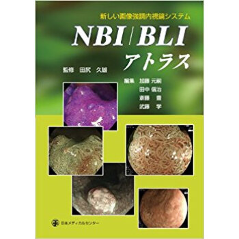 Nbi/Bliアトラス 新しい画像強調内視鏡システム pdf epub mobi 电子书 下载