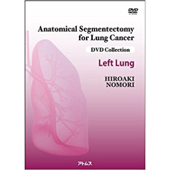 肺癌の解剖学的区域切除術 左肺 Dvd pdf epub mobi 电子书 下载