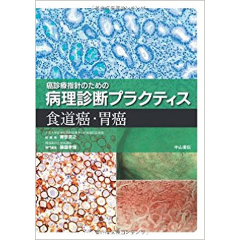 食道癌·胃癌