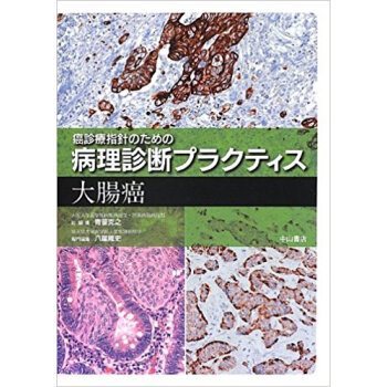 大腸癌 pdf epub mobi 电子书 下载