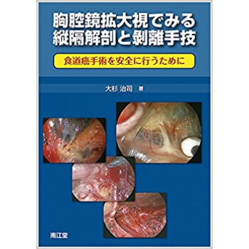 胸腔鏡拡大視でみる縦隔解剖と剥離手技 pdf epub mobi 电子书 下载