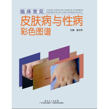 临床常见皮肤病与彩色图谱 畅销书籍 正版 曾文军 pdf epub mobi 电子书 下载