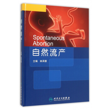 自然流产(精) pdf epub mobi 电子书 下载