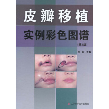 皮瓣移植实例彩色图谱 第2版 邢新 皮瓣移植临床手术图谱 美容外科医师临床参考书籍美容工 pdf epub mobi 电子书 下载