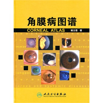 角膜病图谱 pdf epub mobi 电子书 下载