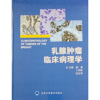 乳腺肿瘤临床病理学阚秀等编北京大学医学出版社 pdf epub mobi 电子书 下载
