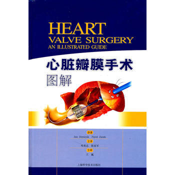 心髒瓣膜手術圖解 pdf epub mobi 電子書 下載