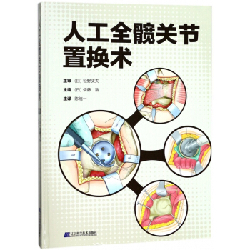 人工全髋关节置换术(精) pdf epub mobi 电子书 下载
