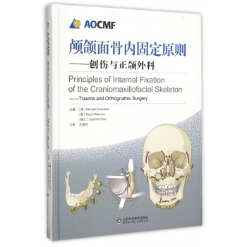 颅颌面骨内固定原则--创伤与正颌外科(精) pdf epub mobi 电子书 下载