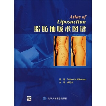 脂肪抽吸术图谱 pdf epub mobi 电子书 下载
