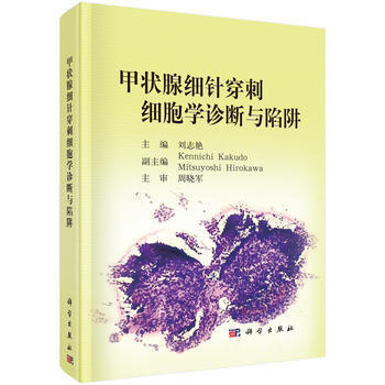 甲狀腺細針穿刺細胞學診斷與陷阱 劉誌艷 科學齣版社