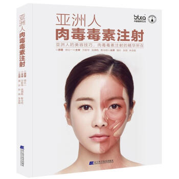 亞洲人肉毒毒素注射