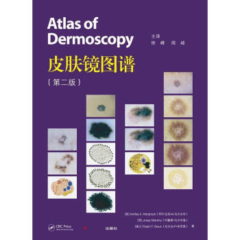 皮肤镜图谱 徐峰等译 复旦大学出版社 图书籍