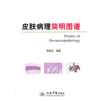 《皮膚病理簡明圖譜》 常建民, 人民軍醫齣版社 pdf epub mobi 電子書 下載