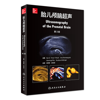 現貨正版 胎兒顱腦超聲 吳青青 薑玉新 主譯 9787117263511 影像醫學 2018年4月參