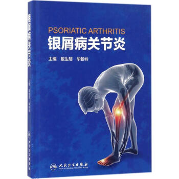 銀屑病關節炎
