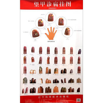 望甲診病掛圖-附說明書 pdf epub mobi 電子書 下載